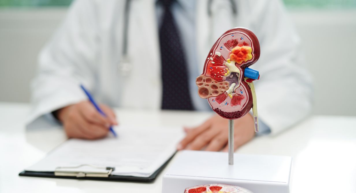 Kidney stones natural remedies